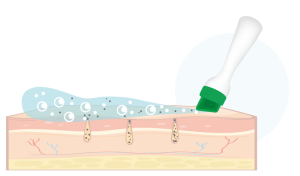 水飛秀第一步：深層清潔軟化老廢角質