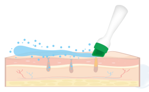 水飛秀第二步：皮脂控油，清潔毛孔粉刺